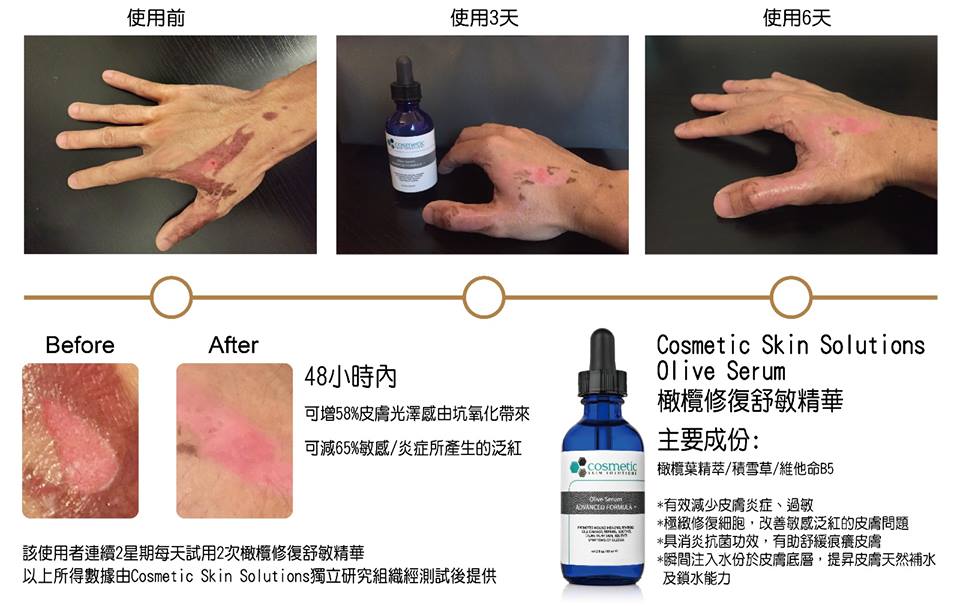 Supreme Olive Serum 4 1