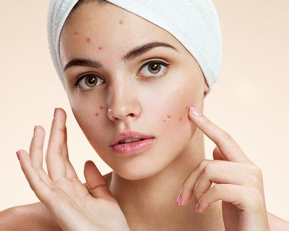 acnes skincare