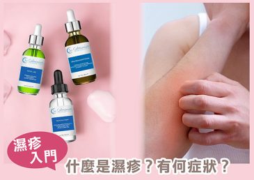 濕疹入門：什麼是濕疹？有何症狀？