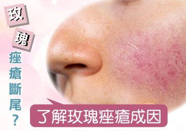 玫瑰痤瘡斷尾？了解玫瑰痤瘡成因