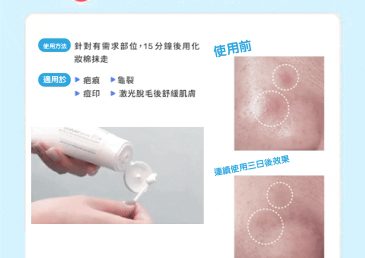「La Roche-Posay B5萬用修復霜」的神奇用法大公開！