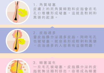 你知道粉刺和黑頭是如何形成的嗎?