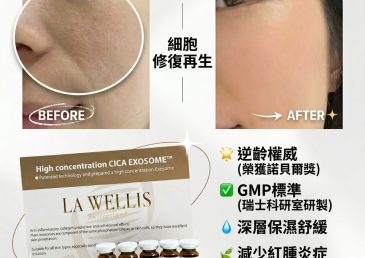 玫瑰痤瘡導致經常泛紅點算好？