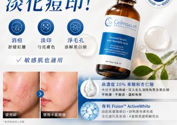 一晚暗瘡消失・淡化痘印！高達20%果酸＋杏仁酸